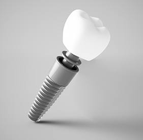 Implant, abutment, and crown against gray background