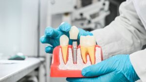 Dentist using model to explain dental implant process